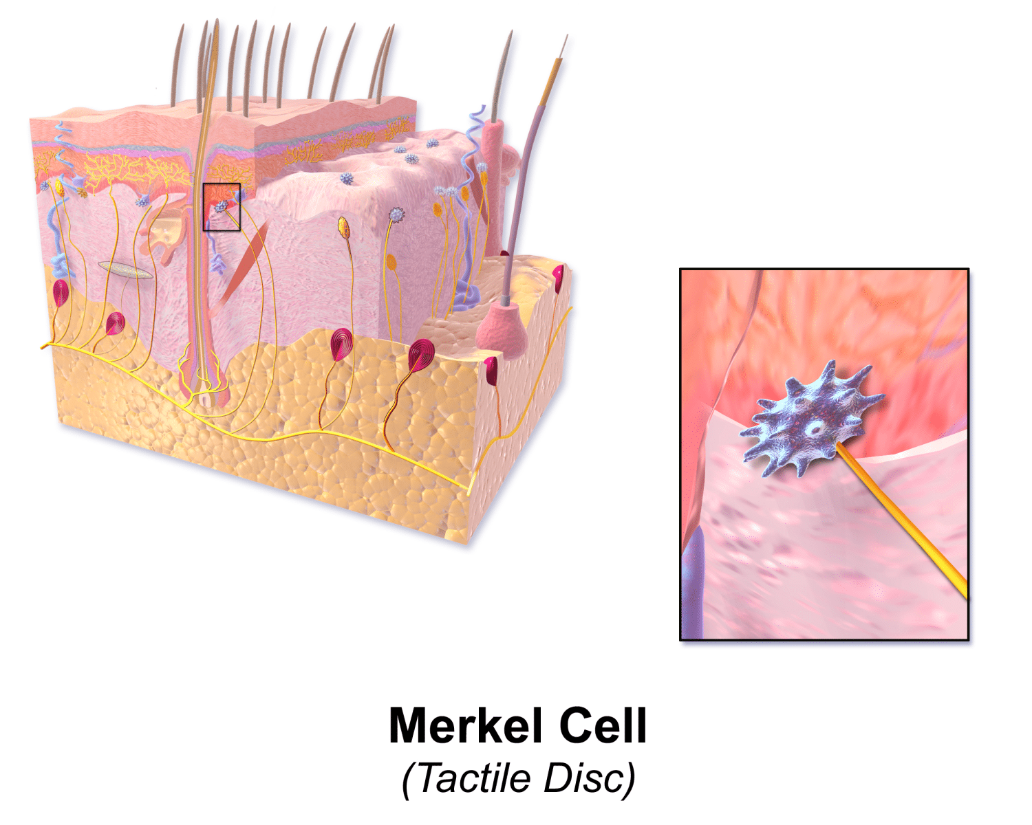 What Is Merkel Cell Carcinoma SERO