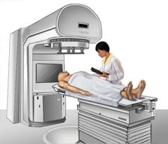 radiation treatment procedure for a cancer patient