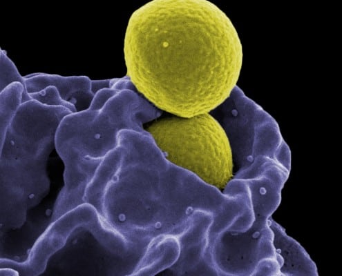 Immunotherapy cancer treatment