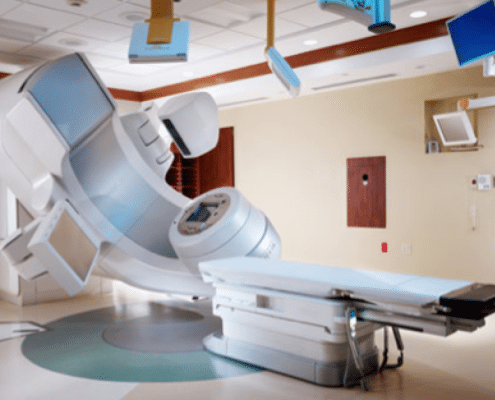 External Beam Radiation Machine | Best Therapy to Treat and Manage Cancer Pain