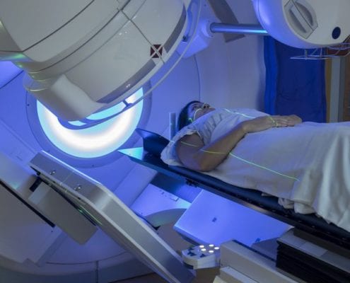 External Beam Radiation Therapy | Common Questions and Misconceptions About Radiation Therapy