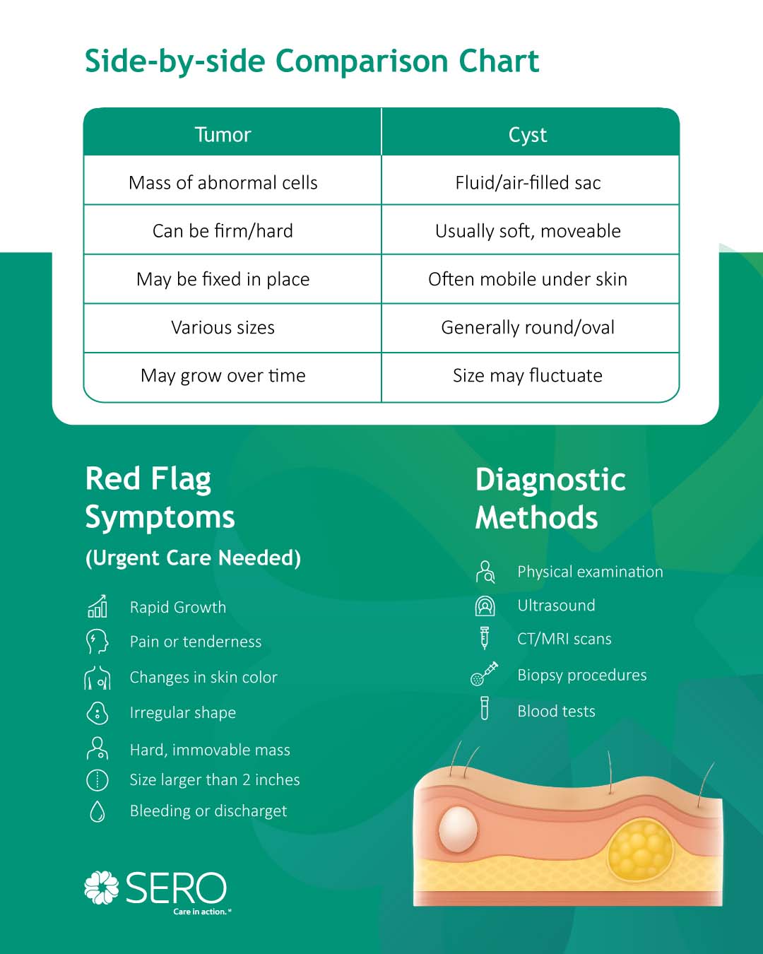 A Comparison of Tumors vs cysts and treatment