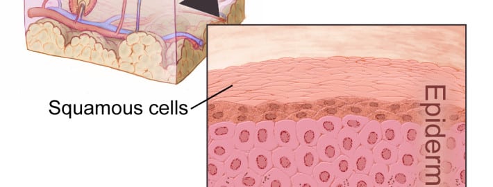 squamous cells and layers of the skin